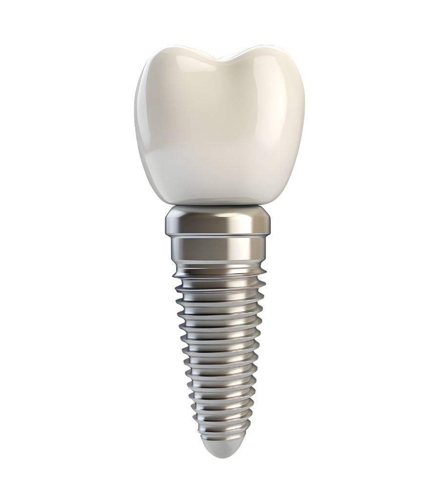 Trồng răng Implant