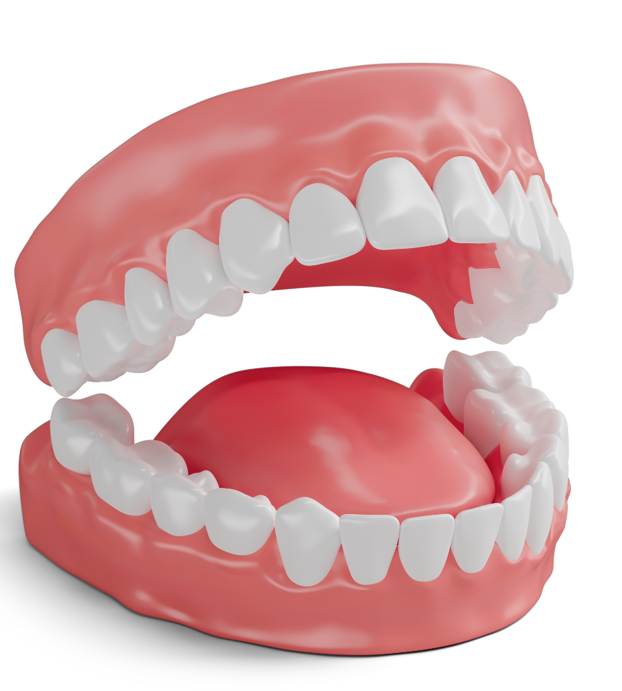 CHỮA CƯỜI HỞ LỢI