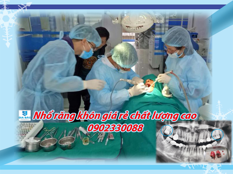 Nhổ răng khôn giá rẻ chất lượng cao tại hải phòng